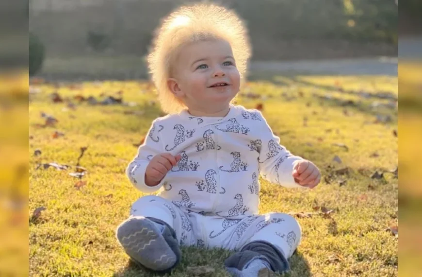 Mom goes into a tailspin after stranger messages her on Instagram about son’s hair and his condition